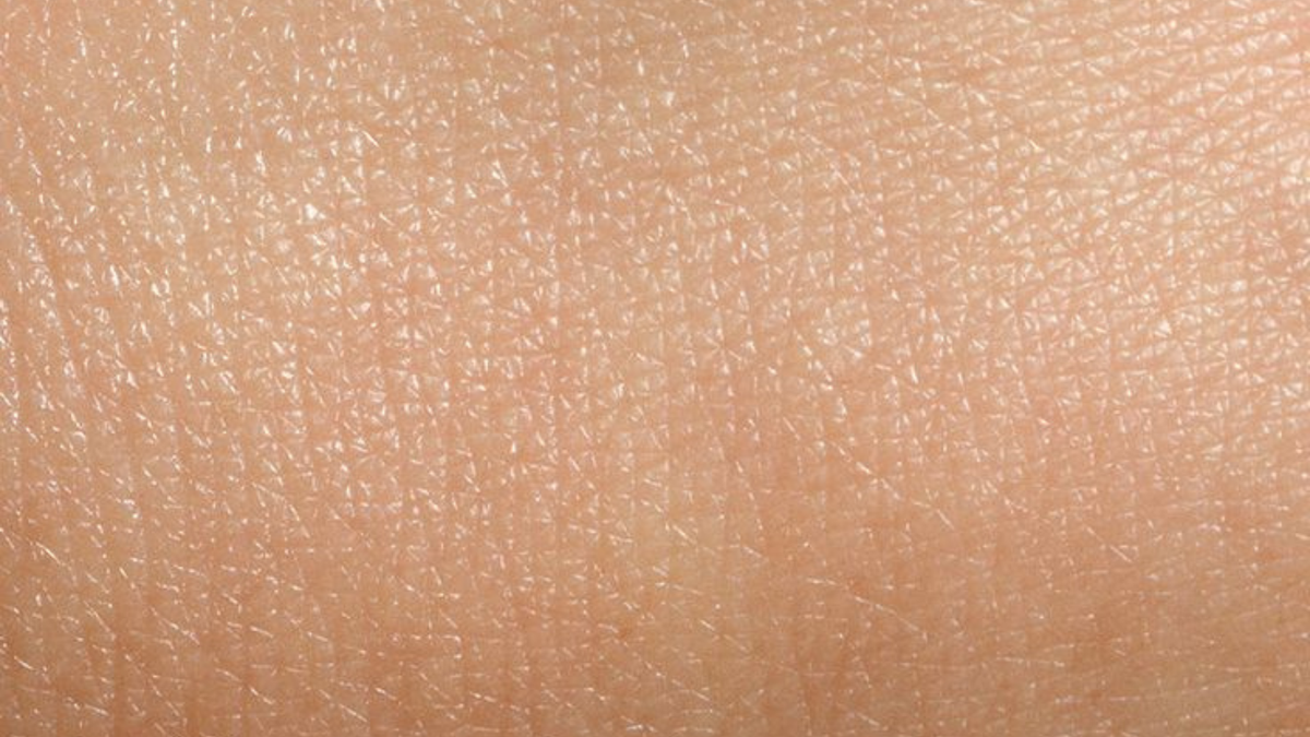 What Causes Hyperpigmentation and How Can You Care for Your Skin?