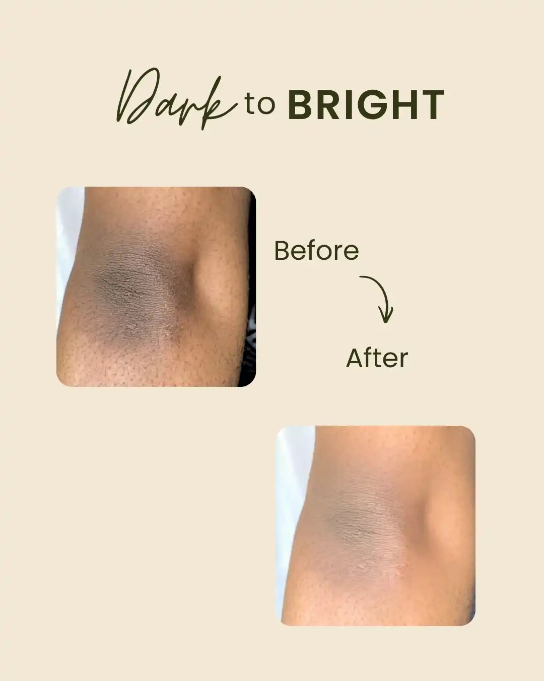 SILKU BUTTER | Brightening Elbow & Knee Balm